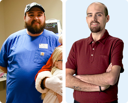 Trevor lost 132 lb. in 3 years and 8 months and 41% of his body weight, and has kept it off for over 8 months*